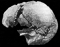 The Castenedolo Homo sapiens skull